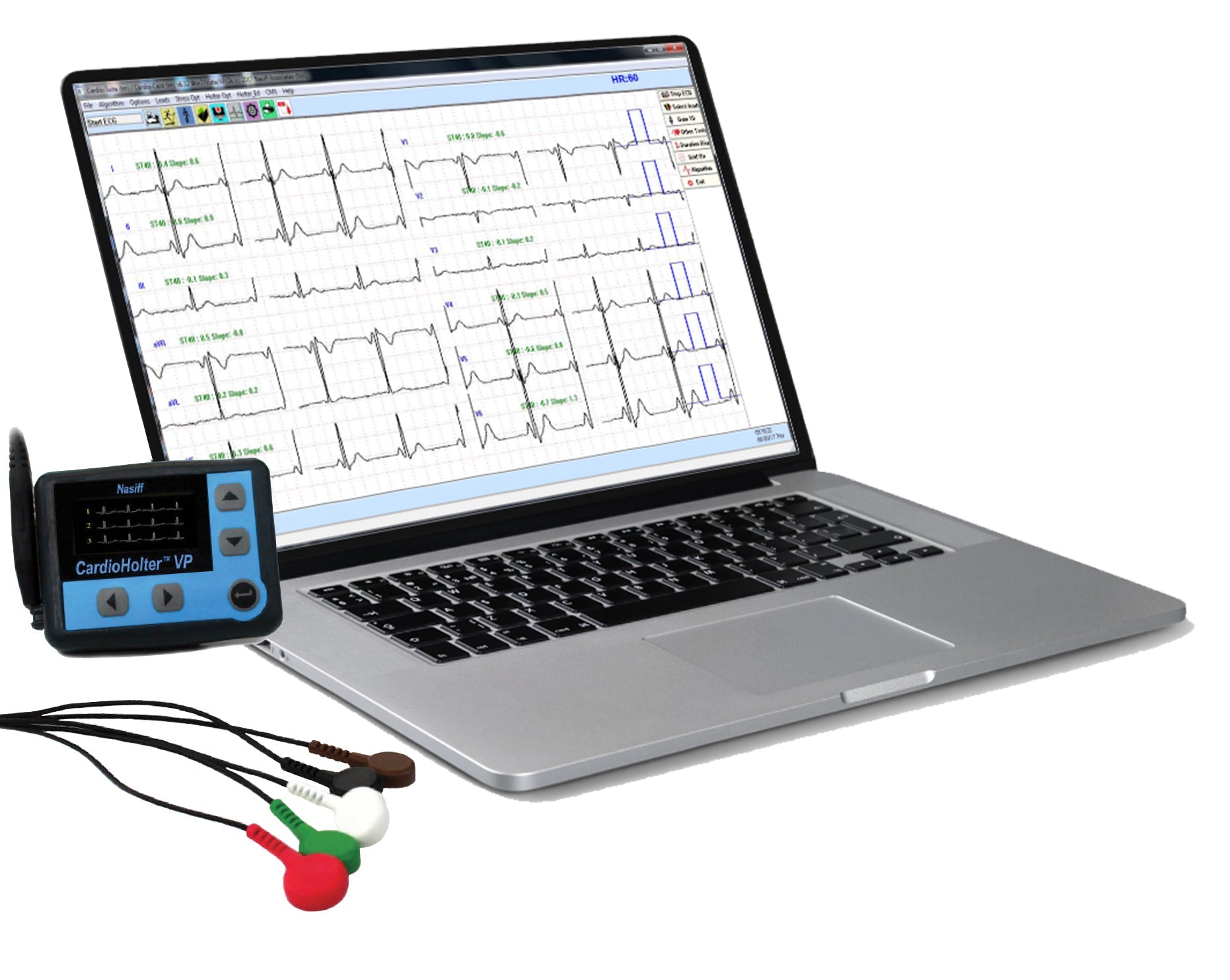 Nasiff PC-Based Cardio Holter System