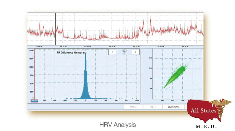 Edan SE 2003 / 2012 Holter monitor