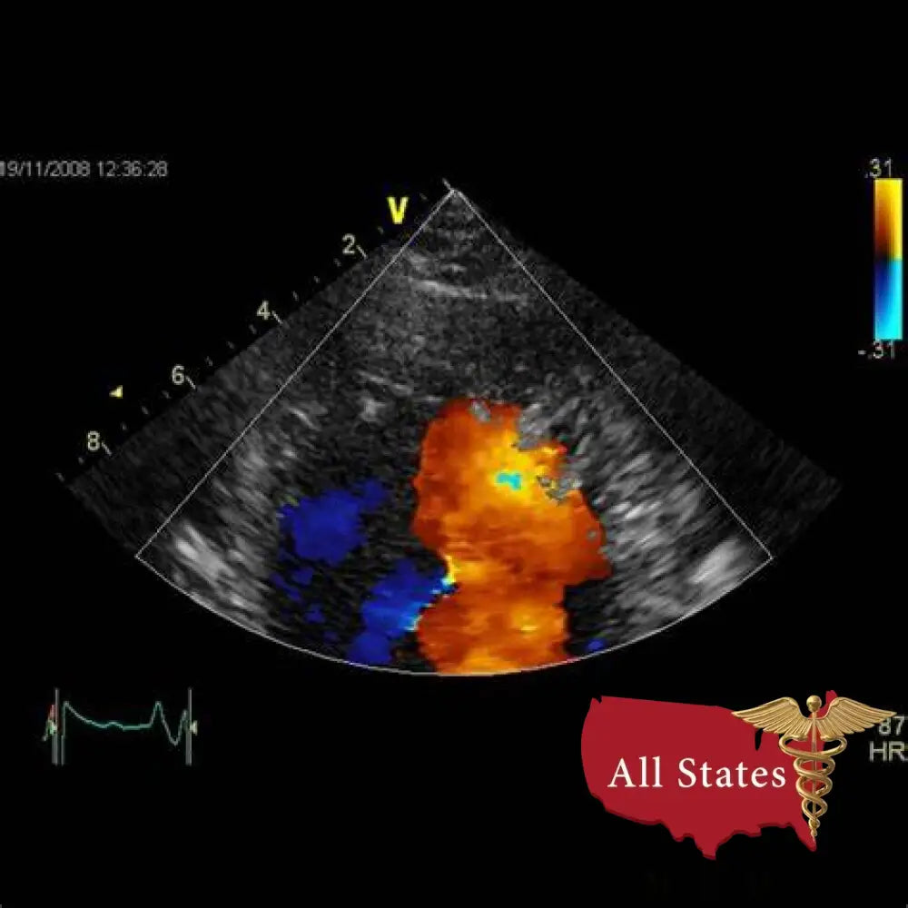 GE Vivid E9 XDClear Refurbished with 3 Probes