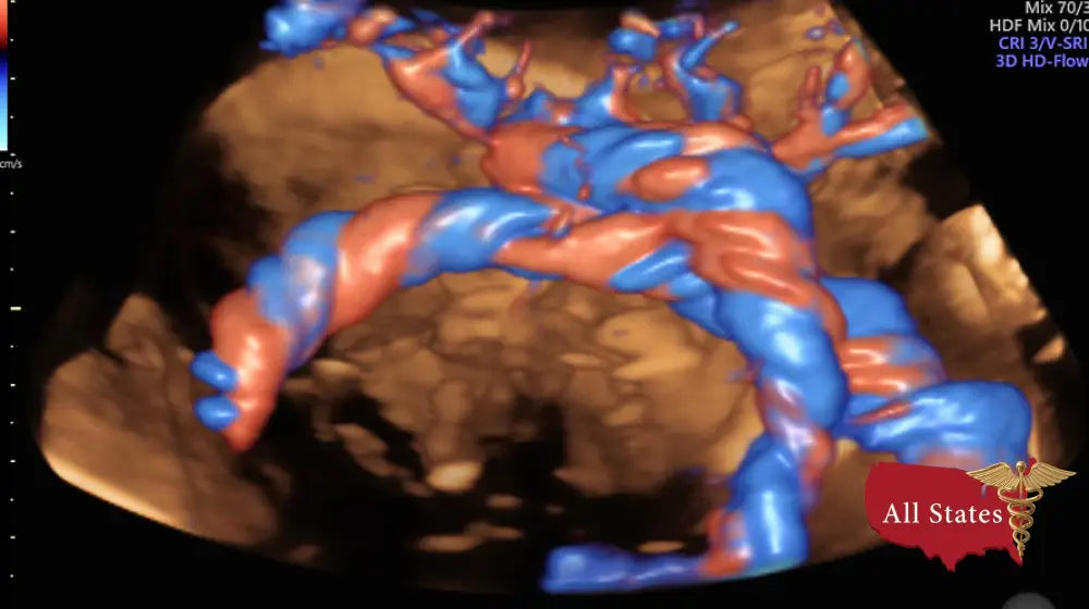 GE VOLUSON E8 Refurbished WITH 3 Probes