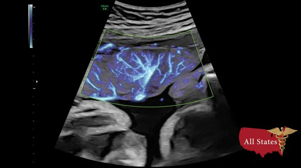 GE VOLUSON E8 Refurbished WITH 3 Probes