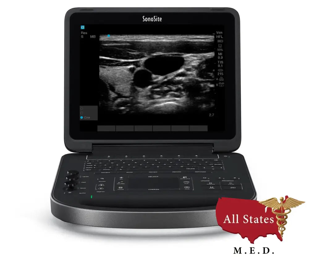 Sonosite EDGE 2 Ultrasound with Linear Probe