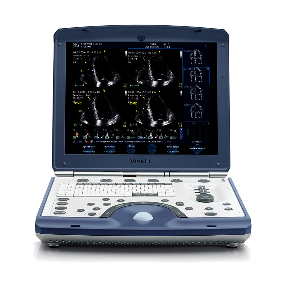 Refurbished GE Vivid I BT12 Ultrasound System