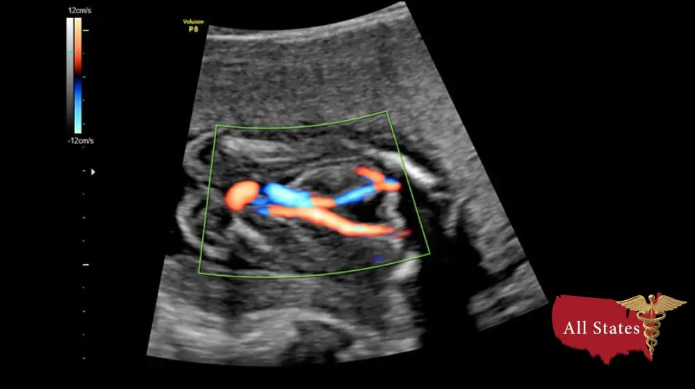 GE VOLUSON P8 BT22 Brand New